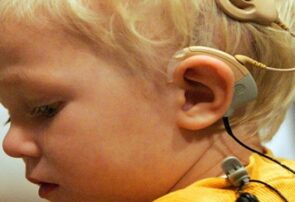 کاشت حلزون شنوایی ‌برای کودکان رایگان شد