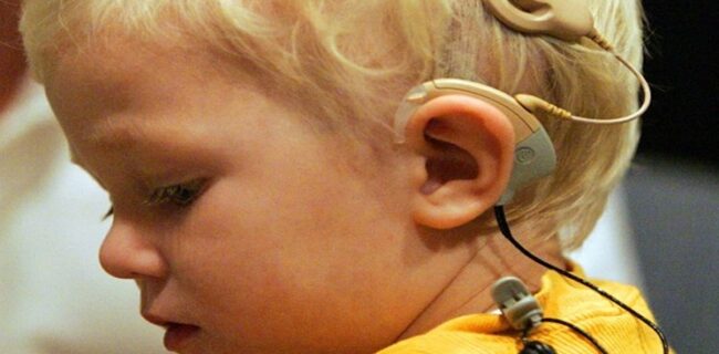 کاشت حلزون شنوایی ‌برای کودکان رایگان شد