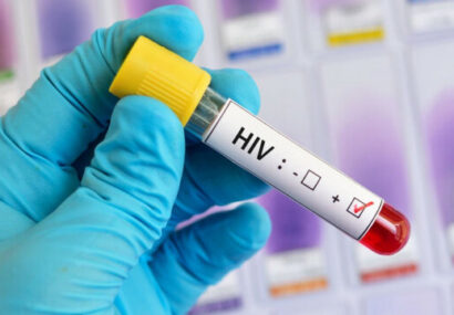 شناسایی ۱۶۸ بیمار مبتلا به اچ آی وی در گلستان