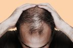 برای جلوگیری از ریزش مو چه کنیم؟ + اینفوگرافیک