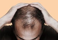 برای جلوگیری از ریزش مو چه کنیم؟ + اینفوگرافیک